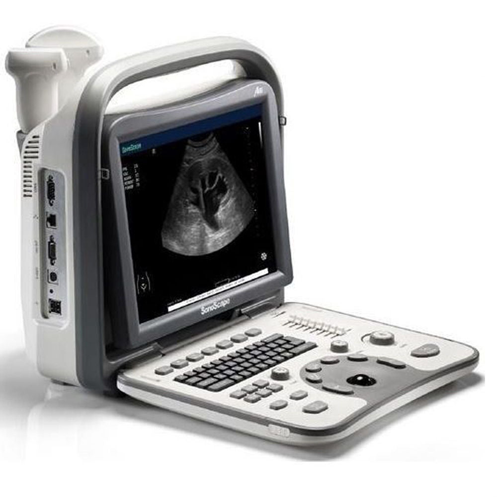 Portable SonoScape A6 Ultrasound Machine Scanner System - Transvaginal & Convex DIAGNOSTIC ULTRASOUND MACHINES FOR SALE