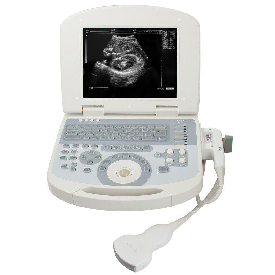 USA Medical Portable Full Digital Laptop Ultrasound Scanner System Convex probe DIAGNOSTIC ULTRASOUND MACHINES FOR SALE