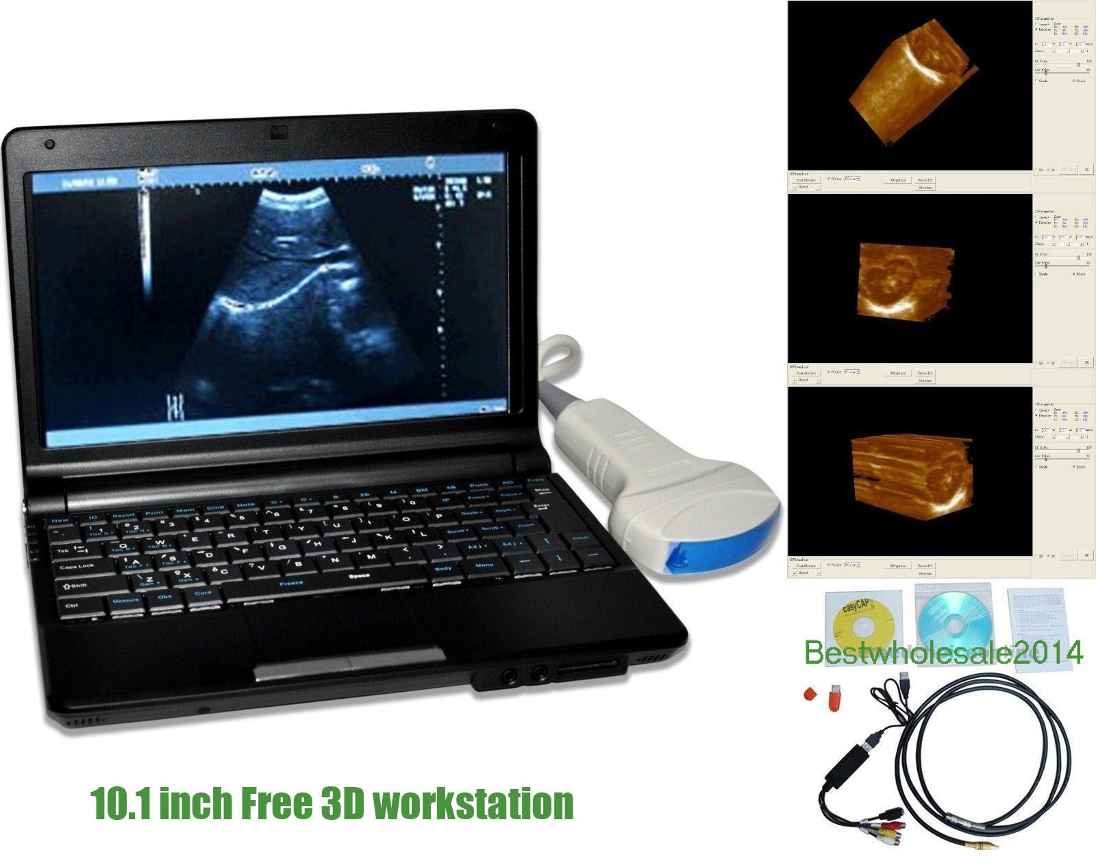 Laptop Ultrasound Scanner Ultrasonic Machine Micro-Convex linear 2 Probes 3D 190891794482 DIAGNOSTIC ULTRASOUND MACHINES FOR SALE