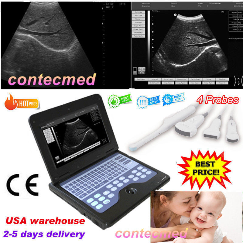 CE Portable Ultrasound Scanner Machine Laptop Diagnostic System(4 Probes Option) DIAGNOSTIC ULTRASOUND MACHINES FOR SALE