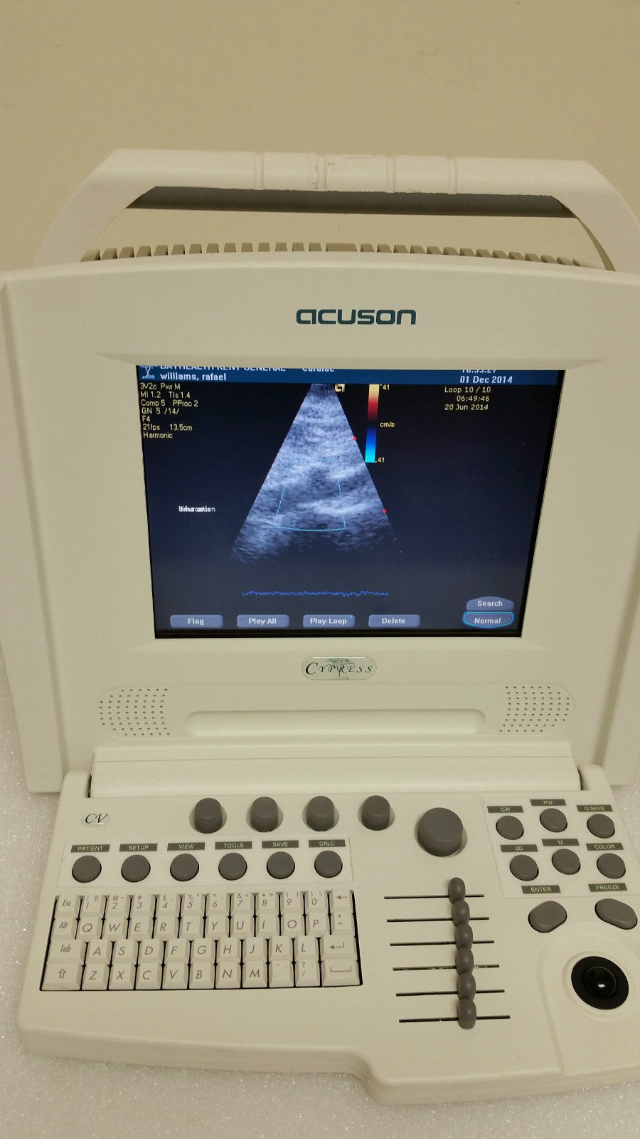 Acuson Cypress Cardiac Vascular Ultrasound Machine Rev 14 + CW, 3V2c, 7L3 Probe DIAGNOSTIC ULTRASOUND MACHINES FOR SALE