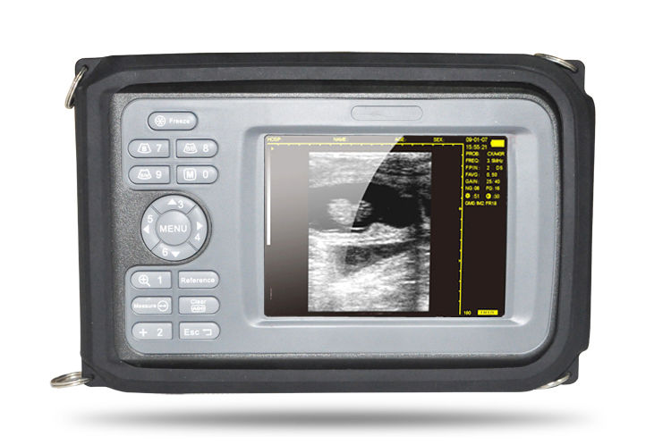 Portable Digital Ultrasound machine Scanner system 6.5 Mhz transvaginal Probe CE DIAGNOSTIC ULTRASOUND MACHINES FOR SALE