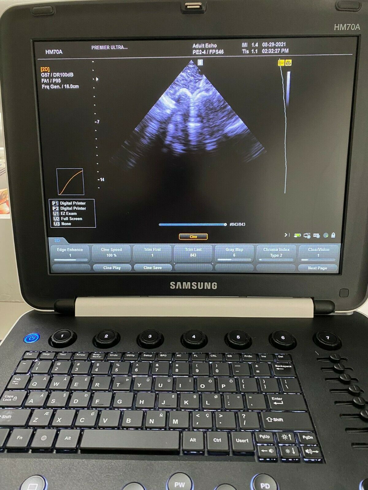 Samsung HM70 portable HM70A with Plus portable Ultrasound machine - 3 probes DIAGNOSTIC ULTRASOUND MACHINES FOR SALE