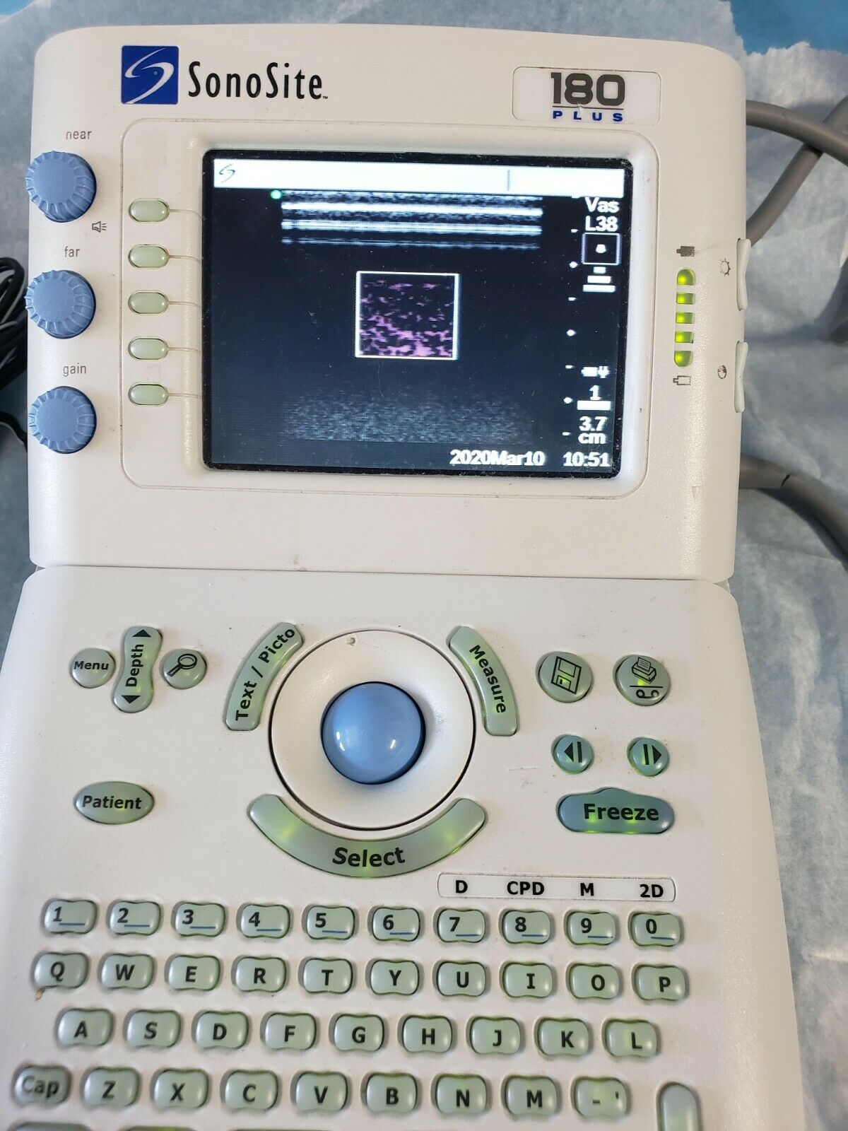 SONOSITE 180 PLUS ULTRASOUND MACHINE WITH 2 TRANSDUCERS DIAGNOSTIC ULTRASOUND MACHINES FOR SALE