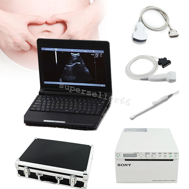 CE Ultrasound Scanner,Convex,Linear,Transvaginal,Probe ,thermal recorder/Printer DIAGNOSTIC ULTRASOUND MACHINES FOR SALE