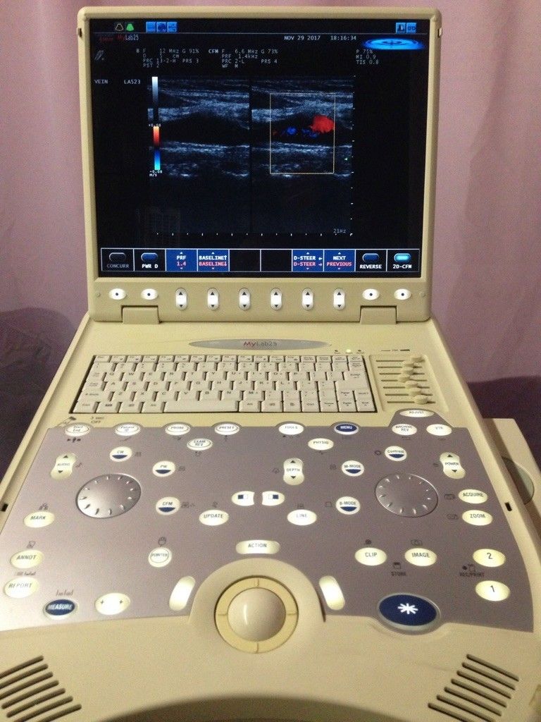 ultrasound machine- 2008 biosound esaote mylab 25 ultrasound,  LA 523 probe DIAGNOSTIC ULTRASOUND MACHINES FOR SALE