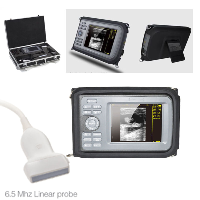 Ultrasound Scanner 5.5'' Digital Palmtop Portable Machine Linear Detector Probe 190891471895 DIAGNOSTIC ULTRASOUND MACHINES FOR SALE