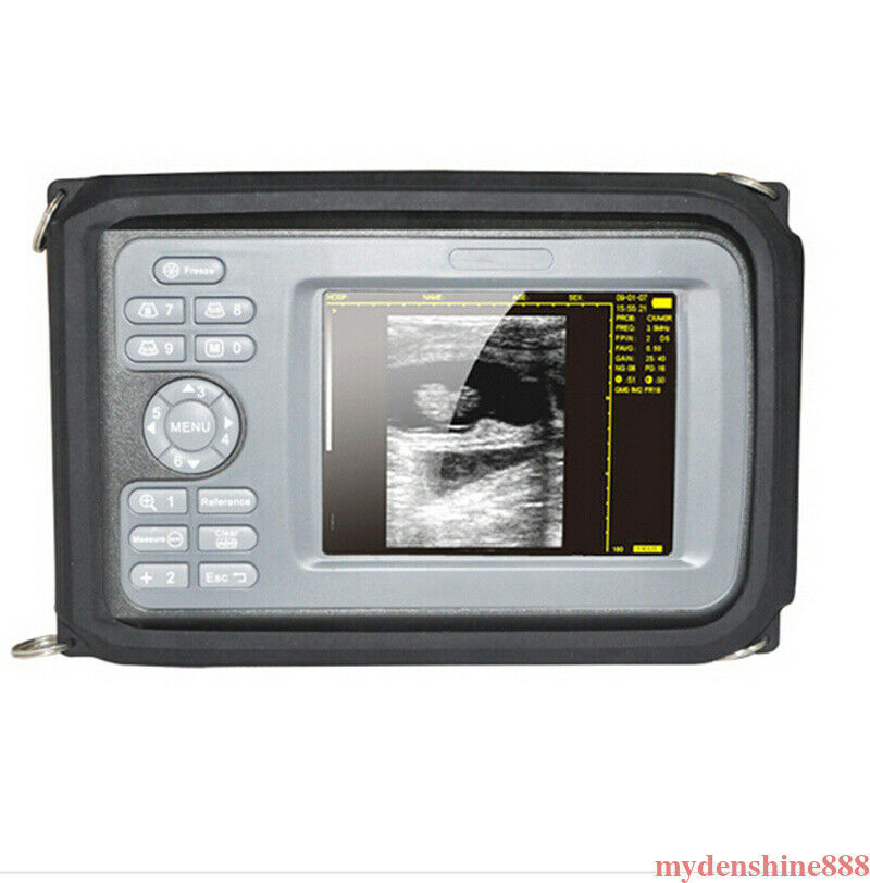 Portable Handheld Human Ultrasound Scanner Machine Monitor 3.5mhz Convex Probe DIAGNOSTIC ULTRASOUND MACHINES FOR SALE