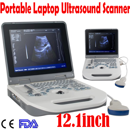 Notebook Digital Laptop Ultrasound Scanner Diagnostic System 3.5MHz Convex+3D DIAGNOSTIC ULTRASOUND MACHINES FOR SALE