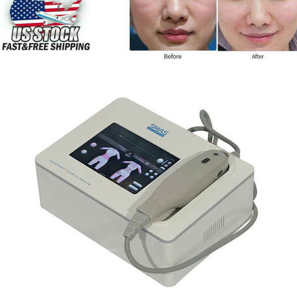 High Intensity Focused Ultrasound HIFU Face Body Lifting Tightening