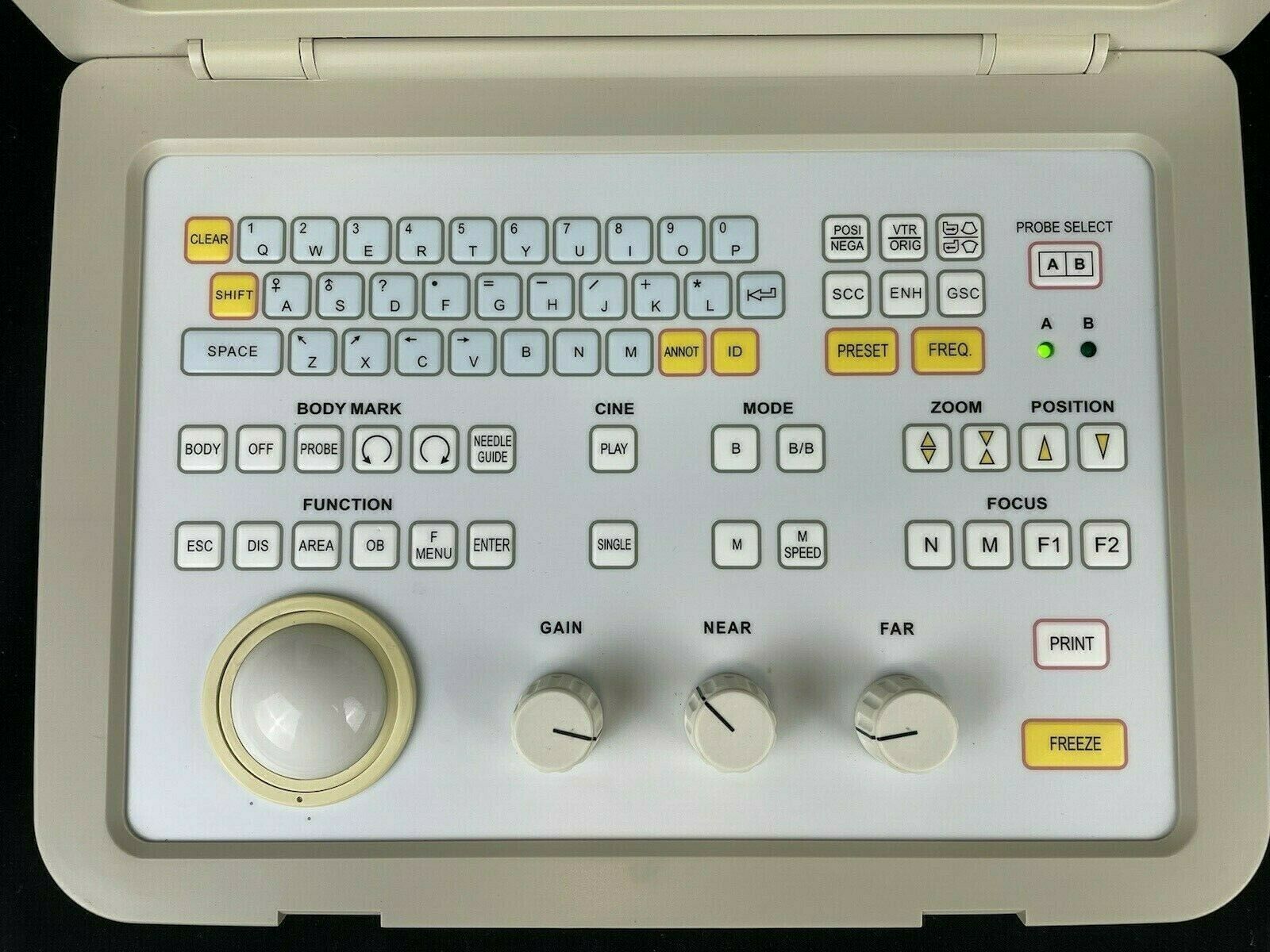 SIUI CTS-485 Ultrasonic Diagnostic Instrument Portable Ultrasound Machine DIAGNOSTIC ULTRASOUND MACHINES FOR SALE