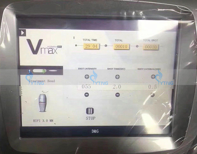 V MAX HIFU Skin Tightening Ultrasound Face Neck Lift Wrinkle Treatment Machine DIAGNOSTIC ULTRASOUND MACHINES FOR SALE