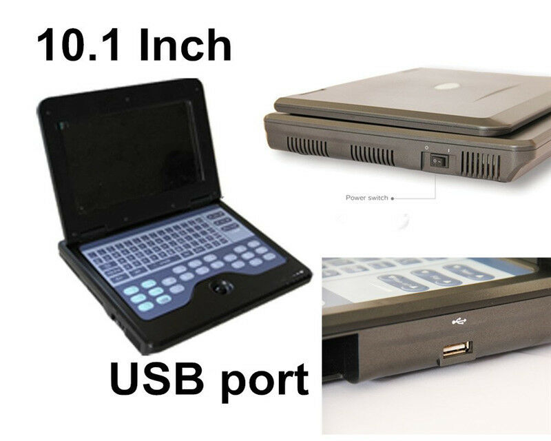 Portable Digital Laptop Ultrasound Scanner Diagnostic Machine,Convex/abdominal DIAGNOSTIC ULTRASOUND MACHINES FOR SALE