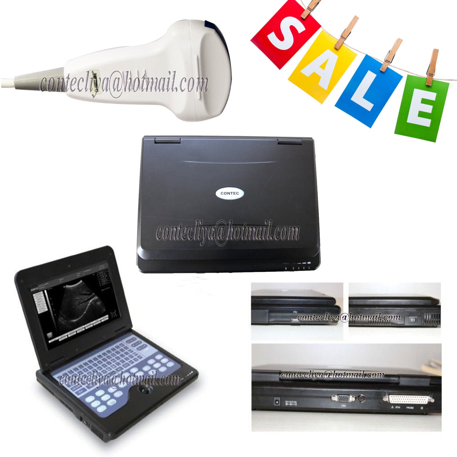 CE Digital Ultrasound Scanner Laptop Machine Diagnostic System Optional 4 Probe DIAGNOSTIC ULTRASOUND MACHINES FOR SALE