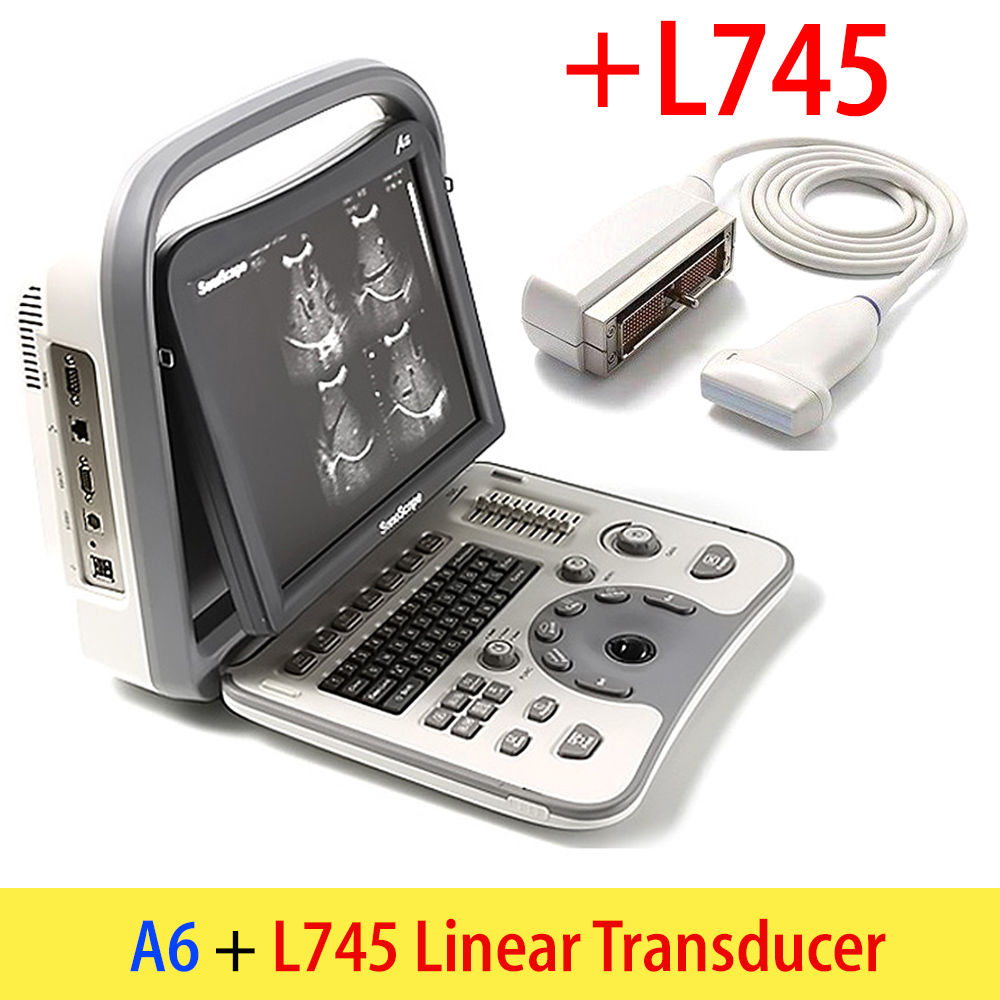 NEW! SonoScape A6 Portable Ultrasound Scanner Machine System + Laptop Style DIAGNOSTIC ULTRASOUND MACHINES FOR SALE