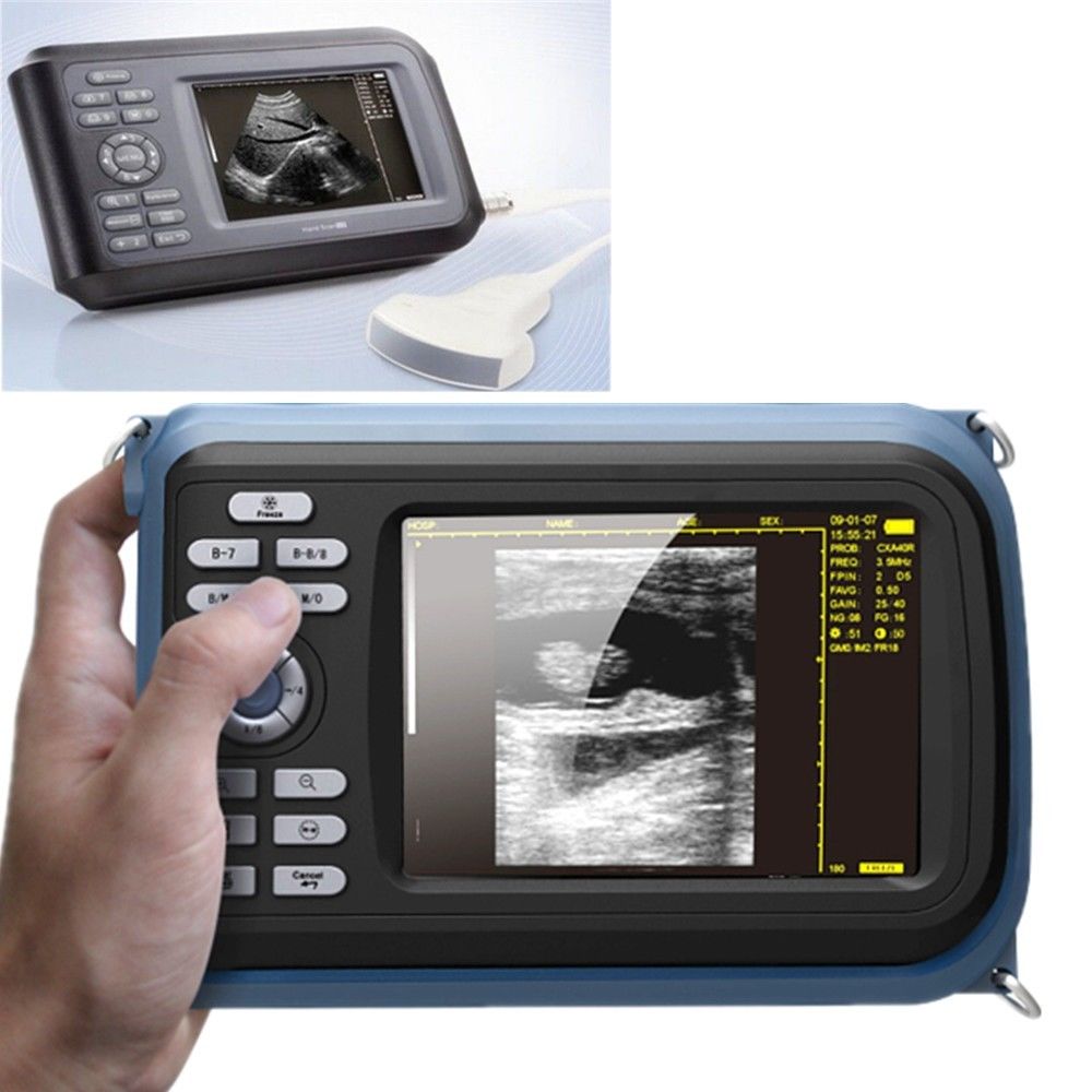 Laptop Machine HandScan Ultrasound scanner Convex + Linear+ Micro Convex Probe DIAGNOSTIC ULTRASOUND MACHINES FOR SALE