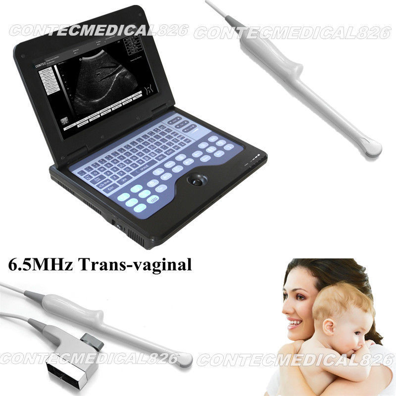 CE Portable Ultrasound Scanner Laptop Machine Diagnostic System Optional 4 Probe DIAGNOSTIC ULTRASOUND MACHINES FOR SALE