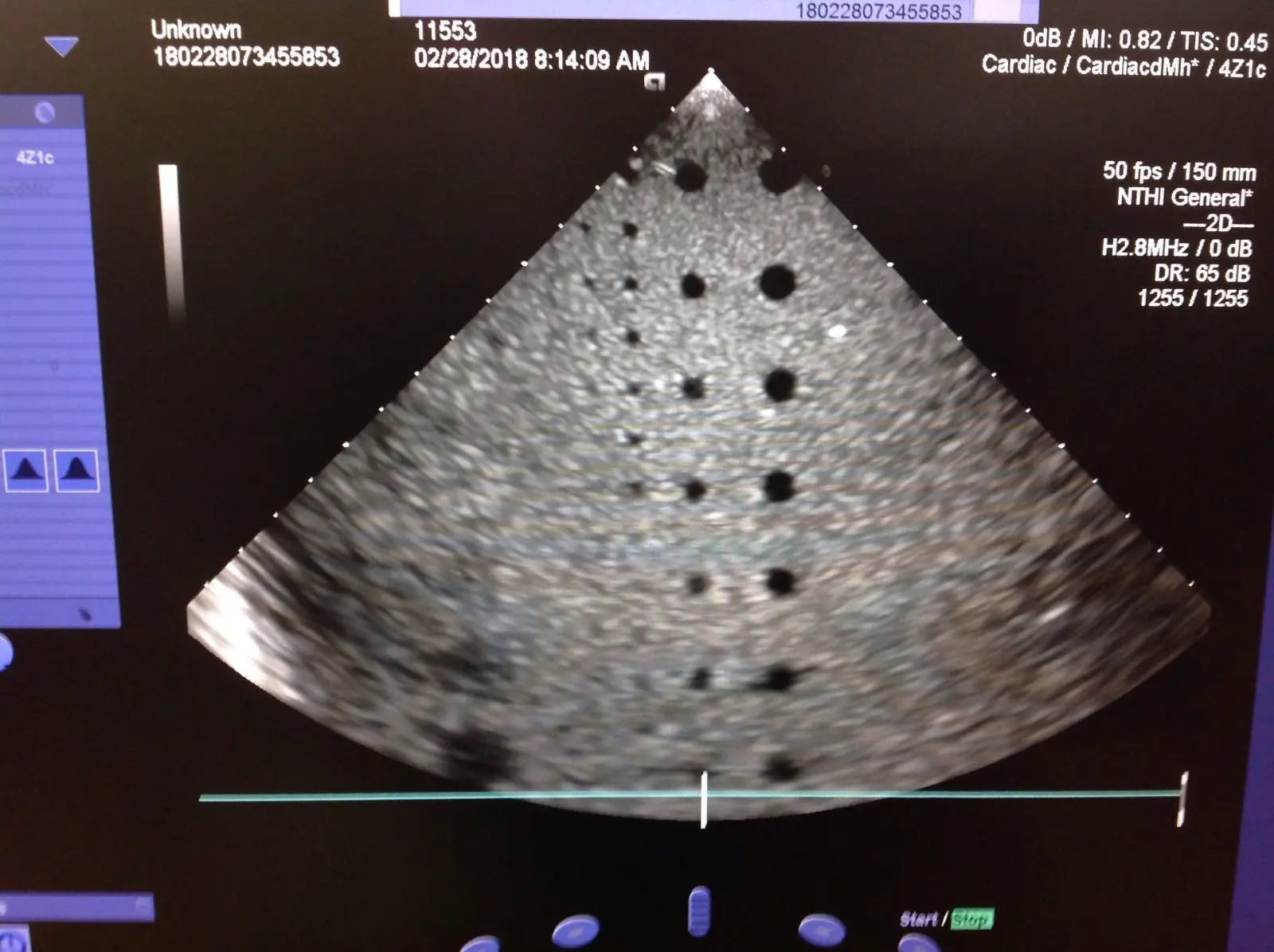 Siemens 4Z1C Ultrasound Probe DIAGNOSTIC ULTRASOUND MACHINES FOR SALE