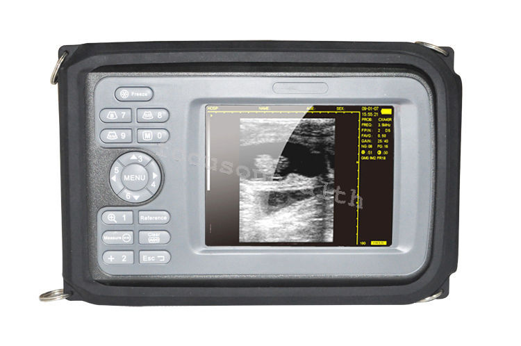 Mankind Digital LCD Smartscan Ultrasound Scanner 5.5 Inch & Micro-convex Probe 190891830081 DIAGNOSTIC ULTRASOUND MACHINES FOR SALE